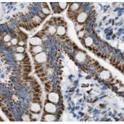 Keratin 19 (KRT19) Antibody