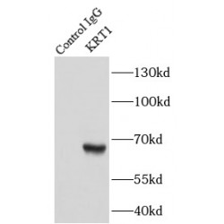 Cytokeratin 1-specific Antibody