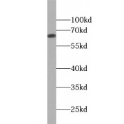 WB analysis of mouse skin tissue, using KRT1-specific antibody (1/1000 dilution).