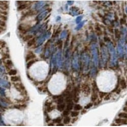 Cytokeratin 20 (CK20) Antibody