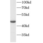 WB analysis of COLO 320 cells, using KRT20 antibody (1/1000 dilution).
