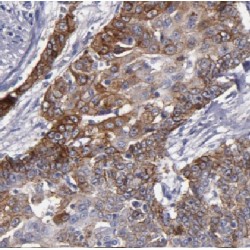 Keratin, Type II Cytoskeletal 4 (KRT4) Antibody