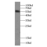 WB analysis of A431 cells, using Cytokeratin 6A-specific antibody (1/600 dilution).