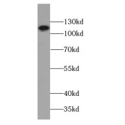 WB analysis of mouse kidney tissue, using CYTSB antibody (1/1000 dilution).