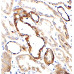 Disabled Homolog 2, Mitogen-Responsive Phosphoprotein (Drosophila) (DAB2) Antibody