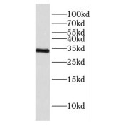 WB analysis of K-562 cells, using CD234 antibody (1/500 dilution).
