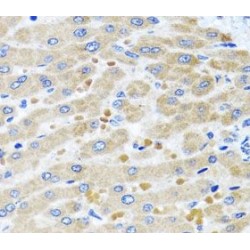 Aspartate-tRNA Ligase, Mitochondrial (DARS2) Antibody