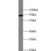 WB analysis of rat brain tissue, using SLC6A3 antibody (1/600 dilution).