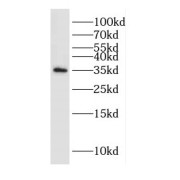 WB analysis of mouse testis tissue, using DAZL antibody (1/400 dilution).