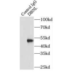 Drebrin-Like Protein (DBNL) Antibody
