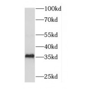 WB analysis of SH-SY5Y cells, using DBP antibody (1/300 dilution).