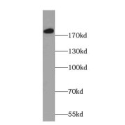 WB analysis of mouse brain tissue, using DCC-Specific antibody (1/600 dilution).