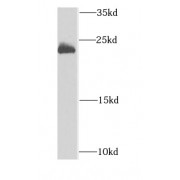 WB analysis of mouse heart tissue, using DCTD antibody (1/1000 dilution).