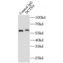 Dynactin Subunit 4 (DCTN4) Antibody
