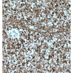 DCN1-Like Protein 1 (DCUN1D1) Antibody