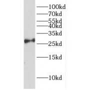 WB analysis of Jurkat cells, using DCUN1D1 antibody (1/3000 dilution).