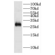 WB analysis of HeLa cells, using DCUN1D5 antibody (1/50 dilution).