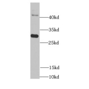 WB analysis of human heart tissue, using DDAH2 antibody (1/1000 dilution).