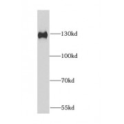 WB analysis of mouse testis tissue, using DDB1 antibody (1/1000 dilution).