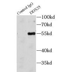 DEAD (Asp-Glu-Ala-Asp) Box Polypeptide 25 (DDX25) Antibody