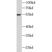 WB analysis of Jurkat cells, using DDX25 antibody (1/600 dilution).