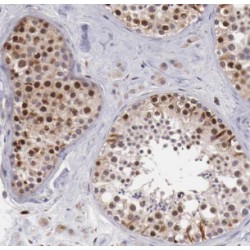 DEAD (Asp-Glu-Ala-Asp) Box Polypeptide 39 (DDX39) Antibody