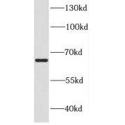 WB analysis of HeLa cells, using DDX52 antibody (1/3000 dilution).