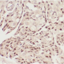 DEAD (Asp-Glu-Ala-Asp) Box Polypeptide 6 (DDX6) Antibody