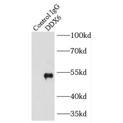 DEAD (Asp-Glu-Ala-Asp) Box Polypeptide 6 (DDX6) Antibody