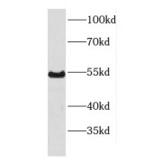 WB analysis of K-562 cells, using P54 antibody (1/500 dilution).