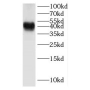 WB analysis of rat brain tissue, using Dematin antibody (1/300 dilution).
