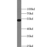 WB analysis of mouse heart tissue, using DES antibody (1/600 dilution).
