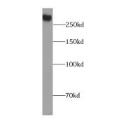 WB analysis of mouse heart tissue, using DSP antibody (1/1000 dilution).