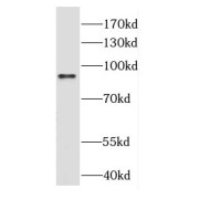 WB analysis of HeLa cells, using DGKB antibody (1/1000 dilution).