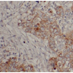 Dehydrogenase/Reductase SDR Family Member 11 (DHRS11) Antibody