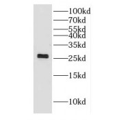 WB analysis of mouse liver tissue, using DHRS11 antibody (1/300 dilution).