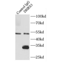 Short-Chain Dehydrogenase/Reductase 3 (DHRS3) Antibody