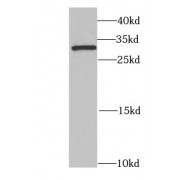 WB analysis of MCF7 cells, using DHRS9 antibody (1/1000 dilution).