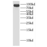 WB analysis of NIH/3T3 cells, using DHX15 antibody (1/600 dilution).