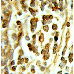 DEAD/H (Asp-Glu-Ala-Asp/His) Box Polypeptide 16 (DHX16) Antibody