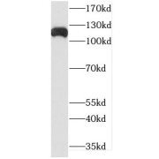 WB analysis of Jurkat cells, using DHX16 antibody (1/1000 dilution).