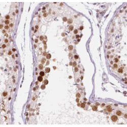 DEAD/H (Asp-Glu-Ala-Asp/His) Box Polypeptide 32 (DHX32) Antibody