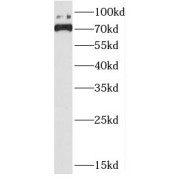 WB analysis of mouse kidney tissue, using DHX32 antibody (1/800 dilution).