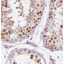 DEAD/H (Asp-Glu-Ala-Asp/His) Box Polypeptide 35 (DHX35) Antibody