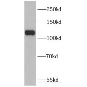 WB analysis of human brain tissue, using DHX36 antibody (1/800 dilution).
