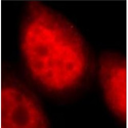 DEAD/H (Asp-Glu-Ala-Asp/His) Box Polypeptide 9 (DHX9) Antibody