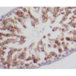 Second Mitochondria-Derived Activator of Caspase / SMAC (DIABLO) Antibody