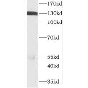 WB analysis of HeLa cells, using DIAPH3 antibody (1/1000 dilution).