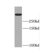 WB analysis of Raji cells, using DIDO1 antibody (1/3000 dilution).