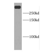 WB analysis of Raji cells, using DIDO1 antibody (1/3000 dilution).